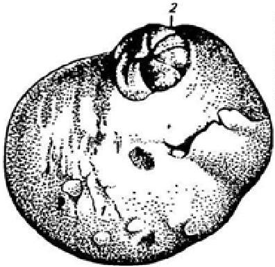 Лютеиновая киста яичника крс